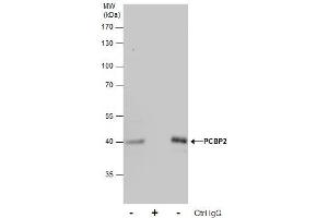 IP Image Immunoprecipitation of PCBP2 protein from Jurkat whole cell extracts using 5 μg of PCBP2 antibody [N1C1], Western blot analysis was performed using PCBP2 antibody [N1C1], EasyBlot anti-Rabbit IgG  was used as a secondary reagent.