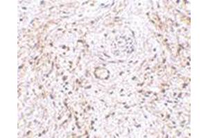 Immunohistochemistry of TEM5 in human bladder tissue with this product at 5 μg/ml. (GPR124 anticorps  (Center))