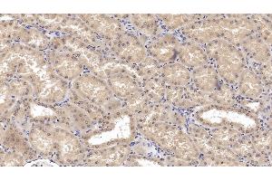 Detection of SHH in Human Kidney Tissue using Monoclonal Antibody to Hedgehog Homolog, Sonic (SHH)