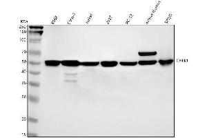 Western blot analysis of Chk1 using anti-Chk1 antibody (ABIN7604428).