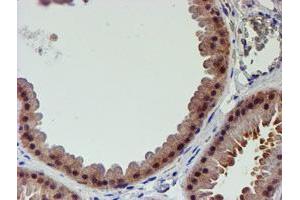 Immunohistochemical staining of paraffin-embedded Human breast tissue using anti-PSMD2 mouse monoclonal antibody. (PSMD2 anticorps)
