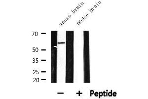 Western blot analysis of extracts from mouse brain, using CDKAL Antibody. (CDKAL1 anticorps  (N-Term))