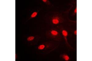 anti-AP2 alpha/beta (C-Term) antibody
