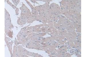 Detection of IFNg in Rat Heart Tissue using Polyclonal Antibody to Interferon Gamma (IFNg)