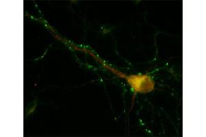 Immunocytochemistry (ICC) image for anti-Early Endosome Antigen 1 (EEA1) (AA 2-13) antibody (ABIN1742484)