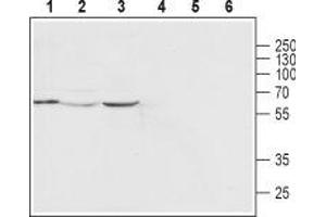 Western blot analysis of human MCF-7 breast adenocarcinoma cell line (lanes 1 and 4), rat heart (lanes 2 and 5) and mouse heart (lanes 3 and 6) lysates: - 1-3. (Mucolipin 2 (MCOLN2) (AA 212-228), (Intracellular), (N-Term) anticorps)