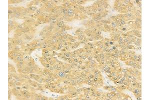 anti-Janus Kinase and Microtubule Interacting Protein 2 (JAKMIP2) (C-Term) antibody