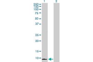 Western Blot analysis of CXCL6 expression in transfected 293T cell line by CXCL6 MaxPab polyclonal antibody. (CXCL6 anticorps  (AA 1-114))