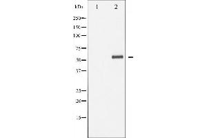 Western blot analysis of p62 Dok phosphorylation expression in Jurkat whole cell lysates,The lane on the left is treated with the antigen-specific peptide. (DOK1 anticorps  (pTyr362))