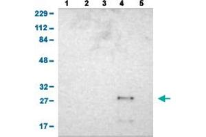Western Blot analysis of (1) human cell line RT-4 (2) human cell line U-251MG sp (3) human plasma (IgG/HSA depleted) (4) human liver tissue, and (5) human tonsil tissue. (ASB6 anticorps  (AA 10-133))