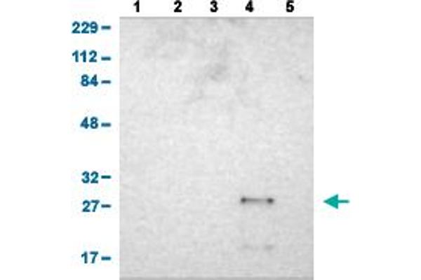 ASB6 anticorps  (AA 10-133)