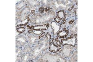 Immunohistochemical staining of human kidney with CLMN polyclonal antibody  shows strong membranous positivity in cells in tubules. (CLMN anticorps)
