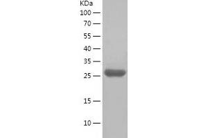 Western Blotting (WB) image for Receptor Tyrosine-Protein Kinase ErbB-3 (ERBB3) (AA 1005-1230) protein (His tag) (ABIN7124803)