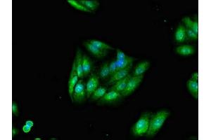 Immunofluorescent analysis of HepG2 cells using ABIN7173463 at dilution of 1:100 and Alexa Fluor 488-congugated AffiniPure Goat Anti-Rabbit IgG(H+L) (TRIM54 anticorps  (AA 60-358))