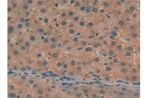 Detection of C6 in Human Liver Tissue using Polyclonal Antibody to Complement Component 6 (C6)