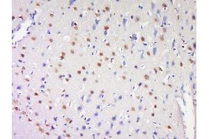 Formalin-fixed and paraffin embedded rat brain labeled with Anti-ProSAPiP1 Polyclonal Antibody, Unconjugated  at 1:200 followed by conjugation to the secondary antibody and DAB staining (ProSAPiP1 anticorps  (AA 151-250))
