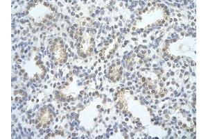 Rabbit Anti-EXOSC2 antibody   Paraffin Embedded Tissue: Human Lung cell Cellular Data: alveolar cell of renal tubule Antibody Concentration: 4.