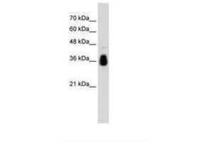 Image no. 1 for anti-Makorin Ring Finger Protein 1 (MKRN1) (AA 371-420) antibody (ABIN203525) (MKRN1 anticorps  (AA 371-420))