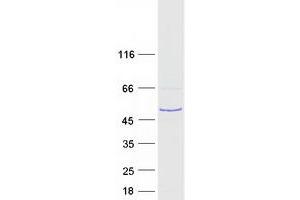 Validation with Western Blot
