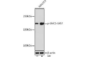 Western blot analysis of extracts of NIH/3T3 cells, using Phospho-SMC1-S957 Rabbit mAb (ABIN7270613) at 1:1000 dilution. (SMC1A anticorps  (pSer957))