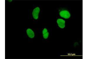 Immunofluorescence of purified MaxPab antibody to GTF3C5 on HeLa cell. (GTF3C5 anticorps  (AA 1-519))