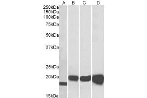 ABIN190907 (0. (SOD1 anticorps  (Internal Region))