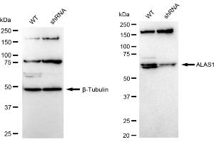 Western blotting analysis using ALAS1 antibody (ABIN7797590).