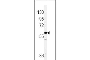 Western blot analysis of Vimentin antibody (C-term) (ABIN389212 and ABIN2839367) in NCI- cell line lysates (35 μg/lane). (Vimentin anticorps  (C-Term))