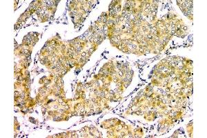 IHC analysis of GM130 using anti-GM130 antibody (ABIN6719433).