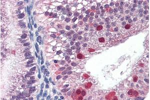 ABIN190919 (3µg/ml) staining of paraffin embedded Human Uterus. (FANCG anticorps  (C-Term))