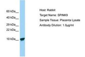 Image no. 1 for anti-Serine Peptidase Inhibitor, Kazal Type 9 (SPINK9) (C-Term) antibody (ABIN6750139)