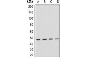 Western blot analysis of PSTPIP1 expression in THP1 (A), mouse spleen (B), mouse brain (C), rat brain (D) whole cell lysates. (PSTPIP1 anticorps)
