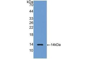Detection of Recombinant LHb, Rat using Polyclonal Antibody to Luteinizing Hormone Beta Polypeptide (LHb) (LHB anticorps  (AA 21-141))