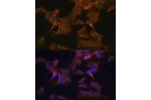 Immunofluorescence analysis of C6 cells using EIF2B2 antibody (ABIN6132131, ABIN6140037, ABIN6140038 and ABIN6222805) at dilution of 1:100. (EIF2B2 anticorps  (AA 1-351))