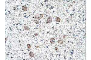 Image no. 1 for anti-Kelch-Like 25 (KLHL25) (AA 163-212) antibody (ABIN203314) (KLHL25 anticorps  (AA 163-212))