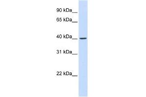 WB Suggested Anti-FBXO28 Antibody Titration: 0.