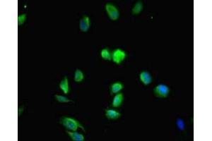 Immunofluorescent analysis of Hela cells using ABIN7159120 at dilution of 1:100 and Alexa Fluor 488-congugated AffiniPure Goat Anti-Rabbit IgG(H+L) (MED29 anticorps  (AA 1-212))