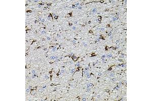 Immunohistochemistry of paraffin-embedded rat brain using TRP antibody (ABIN6133559, ABIN6149565, ABIN6149567 and ABIN6224668) at dilution of 1:100 (40x lens).