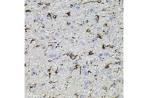 Immunohistochemistry of paraffin-embedded rat brain using TRP antibody (ABIN6133559, ABIN6149565, ABIN6149567 and ABIN6224668) at dilution of 1:100 (40x lens). (TRPA1 anticorps  (AA 850-950))