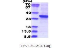 SDS-PAGE (SDS) image for Ras Suppressor Protein 1 (RSU1) (AA 1-277) protein (His tag) (ABIN5853680)
