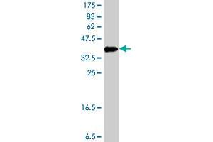 Western Blot detection against Immunogen (37.