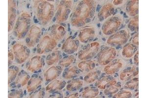 Detection of CTGF in Rat Stomach Tissue using Monoclonal Antibody to Connective Tissue Growth Factor (CTGF)