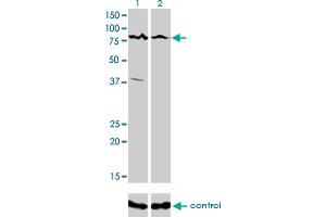 Western blot analysis of ALS2CR8 over-expressed 293 cell line, cotransfected with ALS2CR8 Validated Chimera RNAi (Lane 2) or non-transfected control (Lane 1).