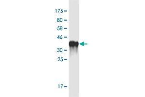 Western Blot detection against Immunogen (35. (Otopetrin 1 anticorps  (AA 415-504))
