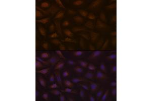 Immunofluorescence analysis of U-2 OS cells using KIF Rabbit mAb (ABIN7268120) at dilution of 1:100 (40x lens).
