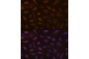 Immunofluorescence analysis of U-2 OS cells using KIF Rabbit mAb (ABIN7268120) at dilution of 1:100 (40x lens). (KIFAP3 anticorps)