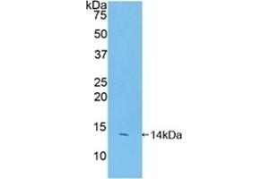 Detection of Recombinant FAM19A2, Mouse using Polyclonal Antibody to Family With Sequence Similarity 19, Member A2 (FAM19A2) (FAM19A2 anticorps  (AA 31-119))