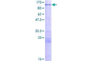 Image no. 1 for Hypermethylated in Cancer 2 (HIC2) (AA 1-615) protein (GST tag) (ABIN1306614)