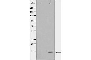 Western blot analysis on HeLa cell lysate using TUSC2 Antibody,The lane on the left is treated with the antigen-specific peptide. (TUSC2 anticorps  (Internal Region))
