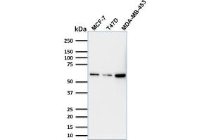 Western Blot Analysis MCF-7; T47D and MDA-MB453 cell lysate using p63 Mouse Monoclonal Antibody (TP63/1786).